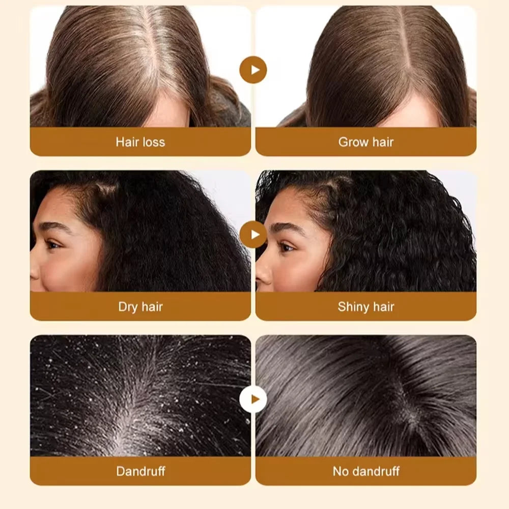 Ensemble de croissance rapide des cheveux, huile de Batana, Traction, masque capillaire d'alopécie, Anti-rupture, perte de cheveux, traitement de la calvitie, soins de santé des cheveux