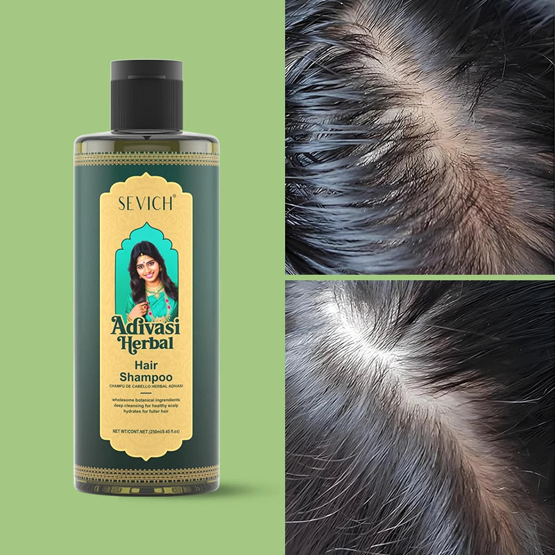 Shampoing pour cheveux, 250ml, pour une croissance rapide des cheveux, soins capillaires à base de plantes, huile de gingembre, réparation des cheveux endommagés, traitement nourrissant