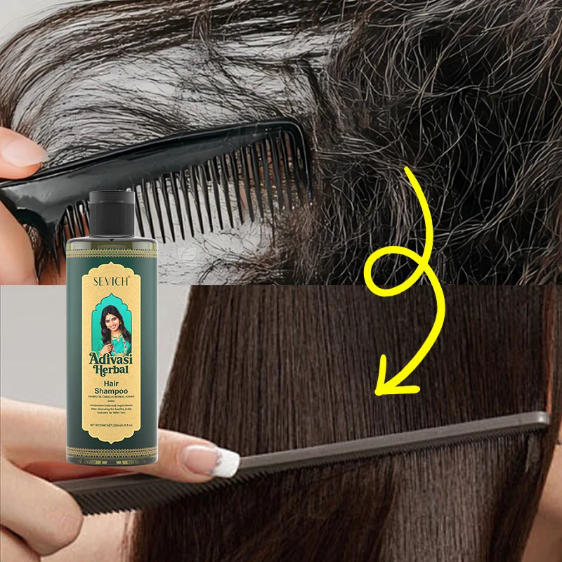 Shampoing pour cheveux, 250ml, pour une croissance rapide des cheveux, soins capillaires à base de plantes, huile de gingembre, réparation des cheveux endommagés, traitement nourrissant