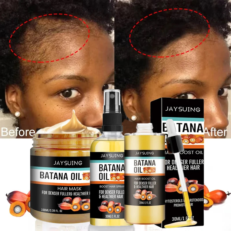 Ensemble de croissance rapide des cheveux, huile de Batana, Traction, masque capillaire d'alopécie, Anti-rupture, perte de cheveux, traitement de la calvitie, soins de santé des cheveux
